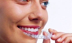  Protezy zębowe